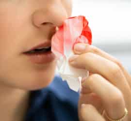 Was hilft bei Nasenbluten und was nicht?